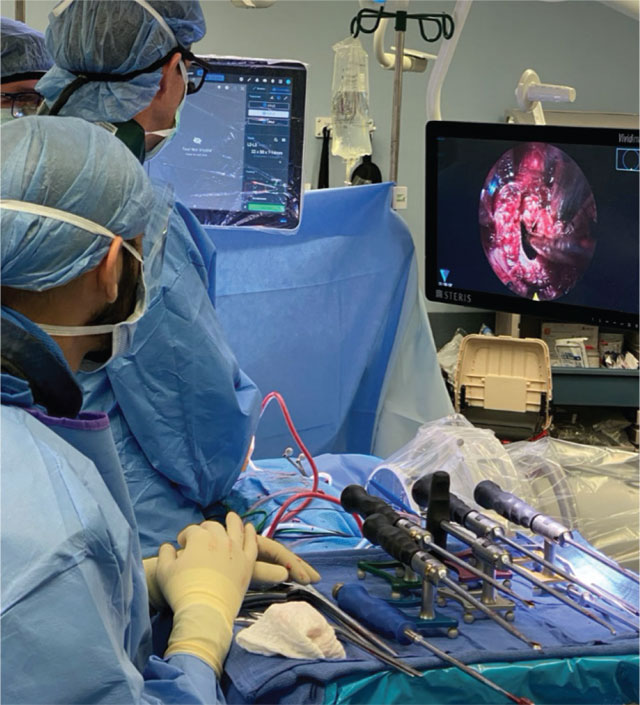 Intraoperative photographs showing the use of the robotic 3D navigation instruments to perform lateral lumbar fusion and deformity correction under endoscopic visualization.