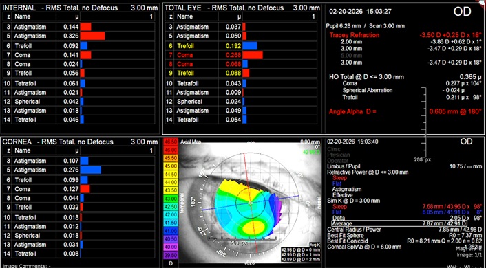 Figure 1 I Trace aberrometry analysis of right eye