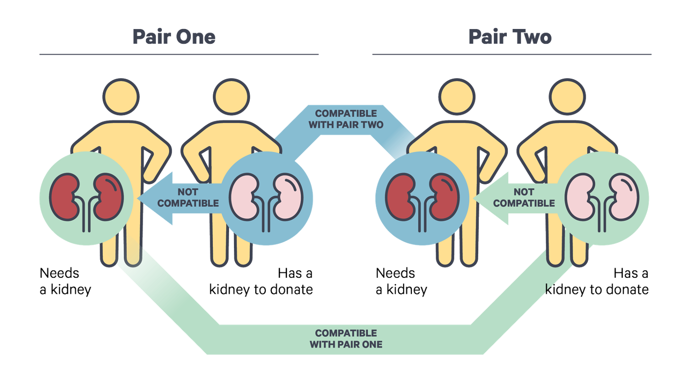 A pair of people, one needs a kidney and one is not compatible. The second pair has the same issue of being in-compatible donor. Yet one person in each pair has a compatible kidney for the other group. The compatible donors in each of the group is able to swap kidneys, solving all incompatible issues.