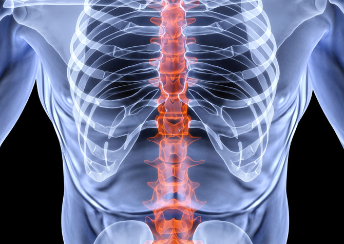 Spinal Stenosis - Oaklawn