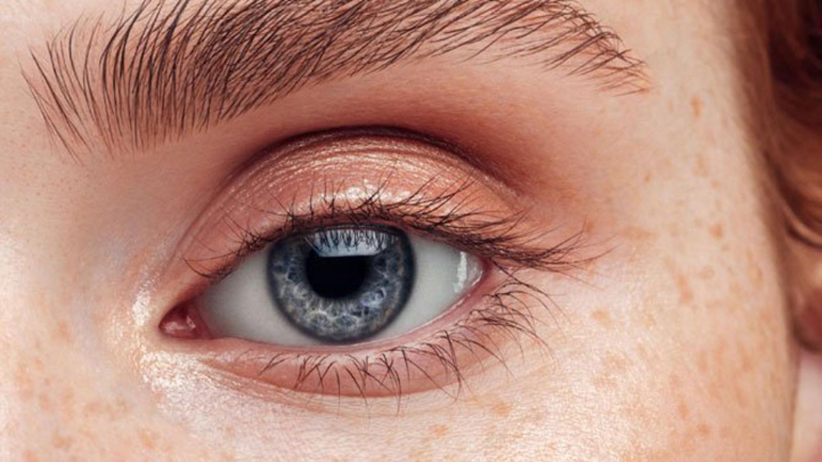 common eye issues