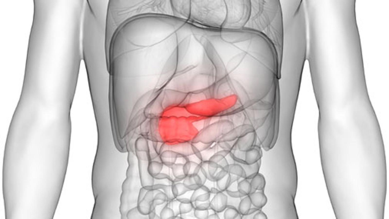 Pancreatic Cancer