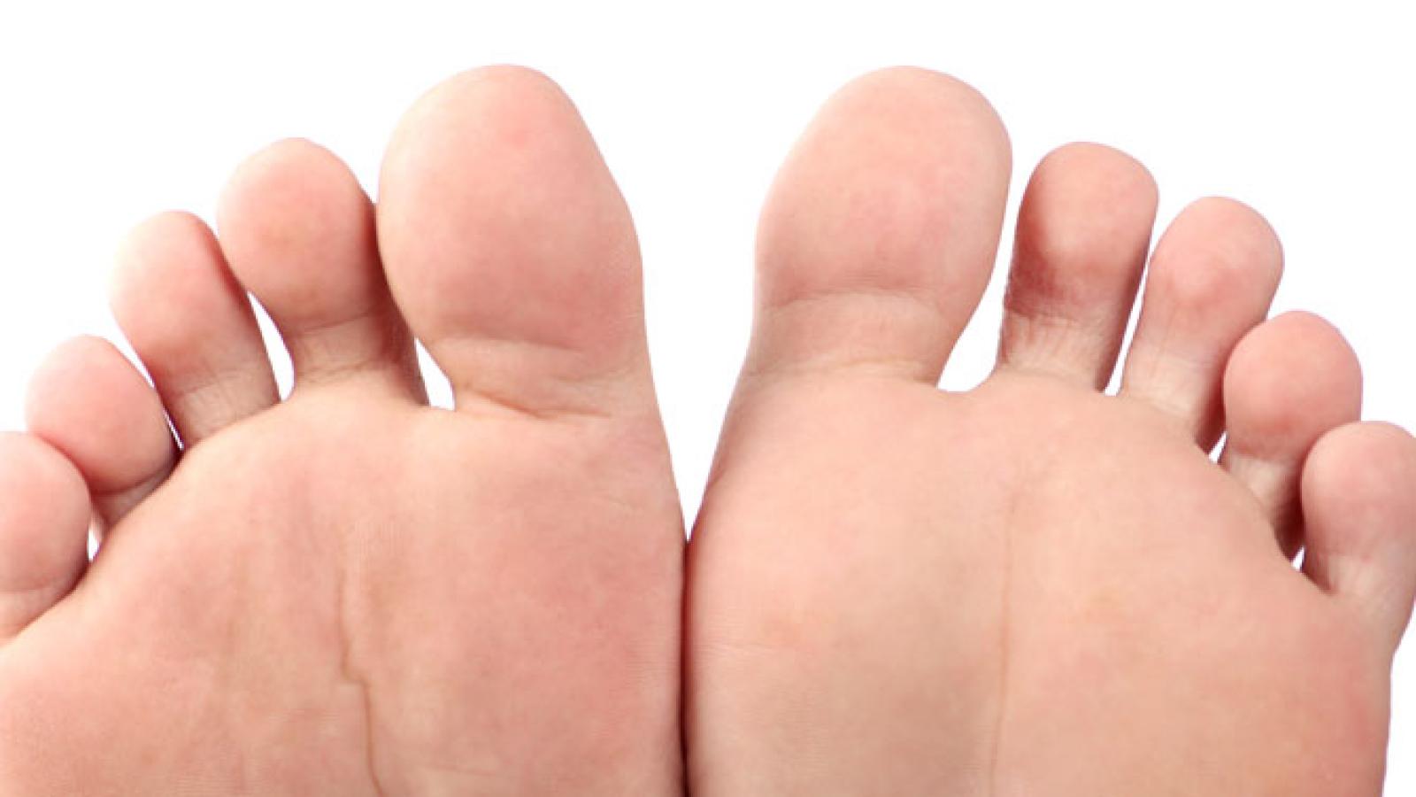 5-facts-about-gout.jpg