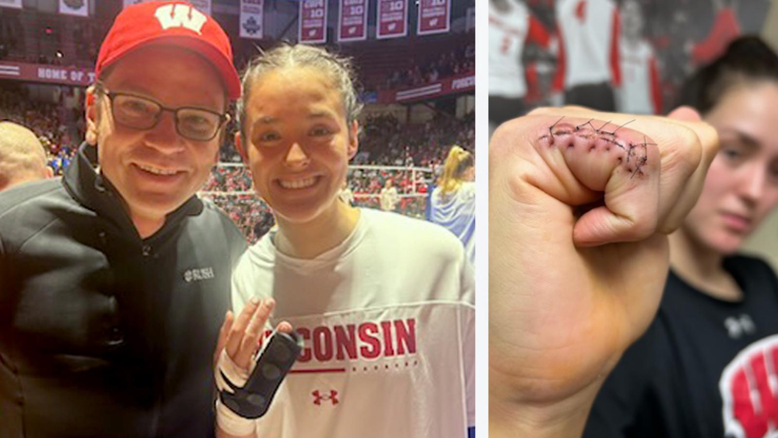Dr. Tueting and patient Caroline and close-up of her injured finger