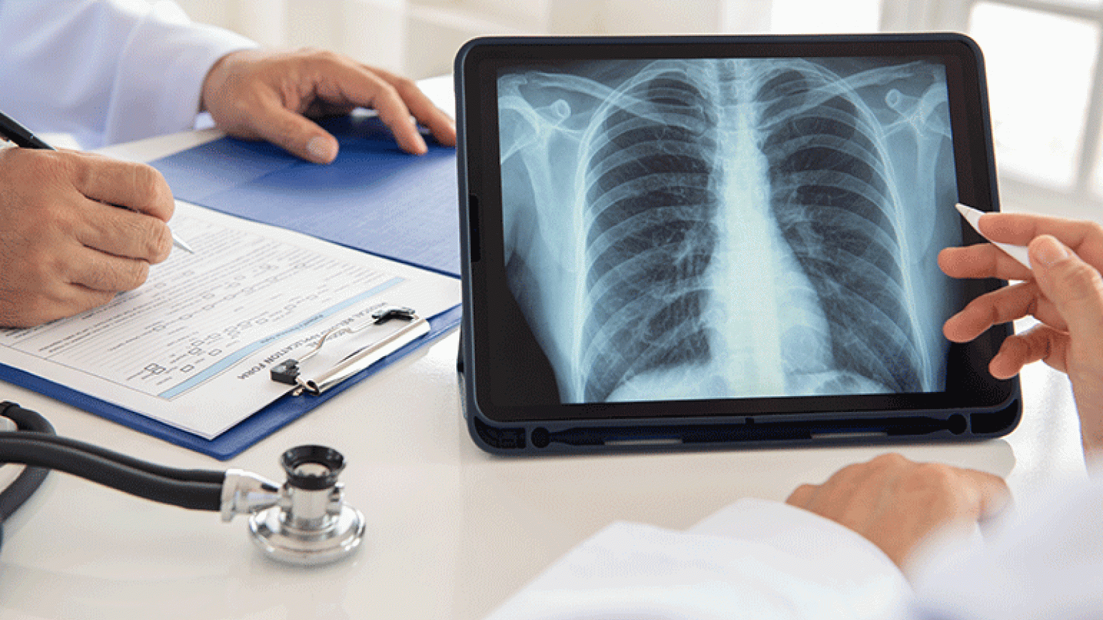 Looking at a picture of a lung screening