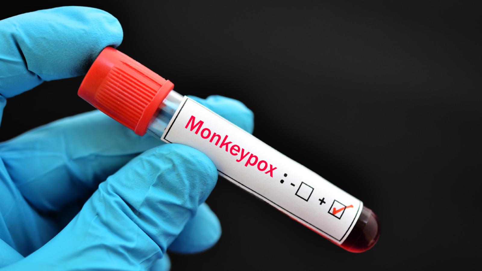 Protect From Monkeypox