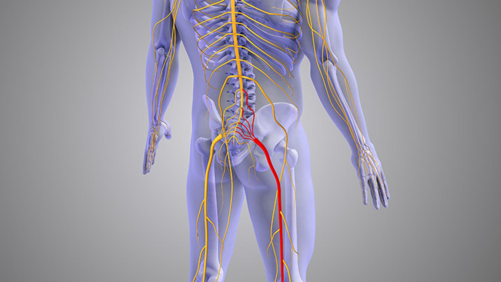 Image of sciatica nerves
