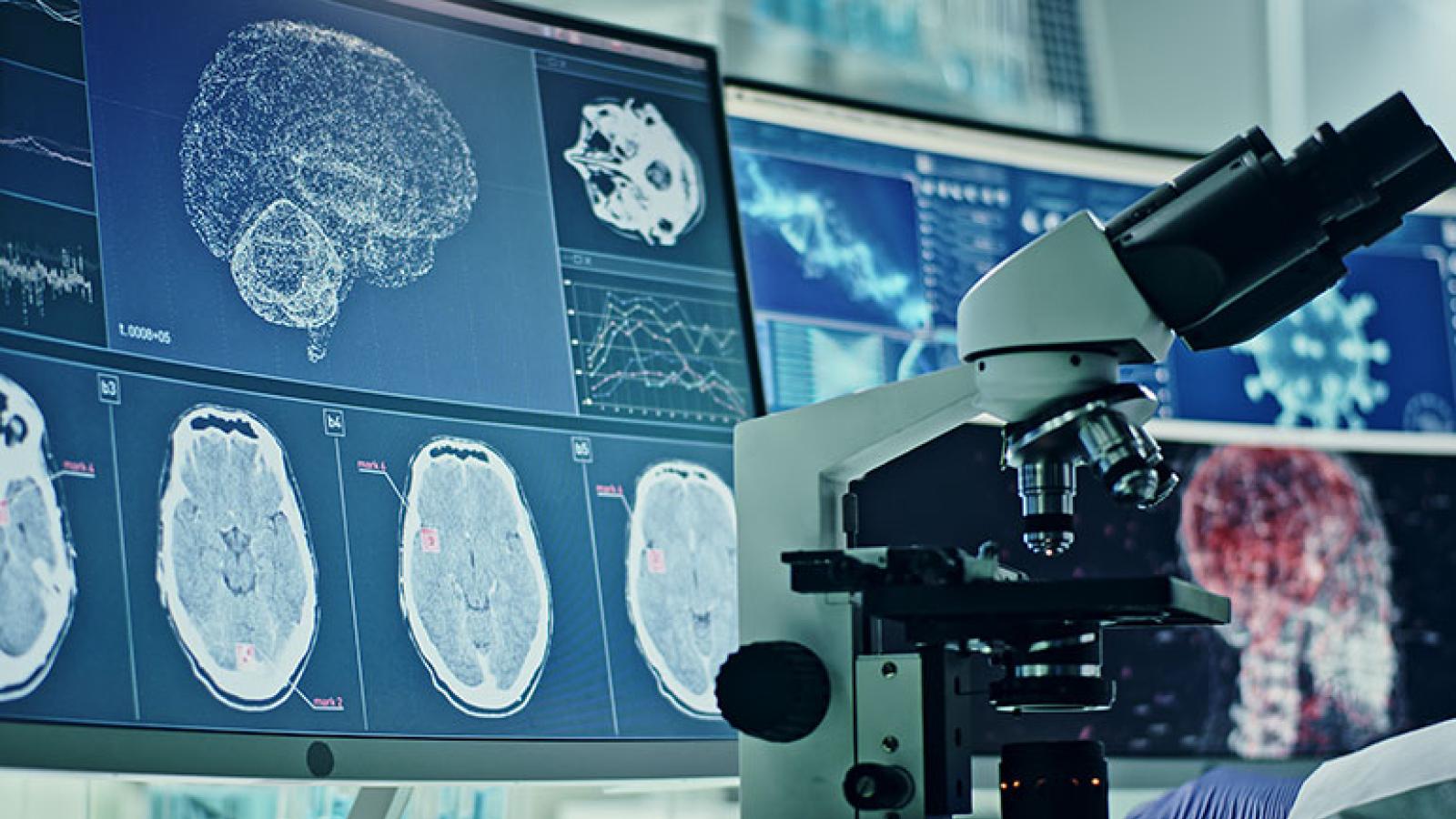 COVID Alzheimer's research