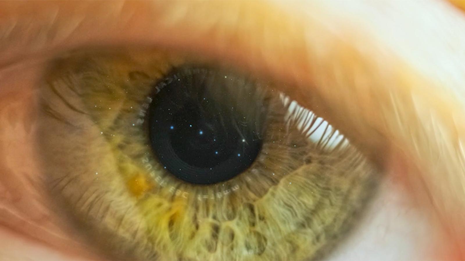 Close-up on a human eye