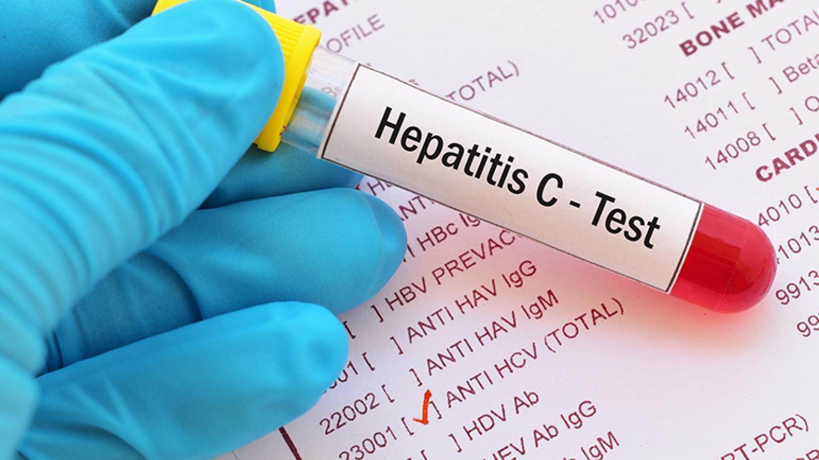 Test vial with "hepatitis C test" written on it over a lab report with a checked box next to "hepatitis c"