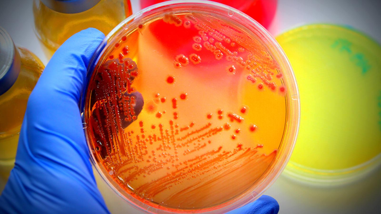 A brightly-colored petri dish with cell cultures