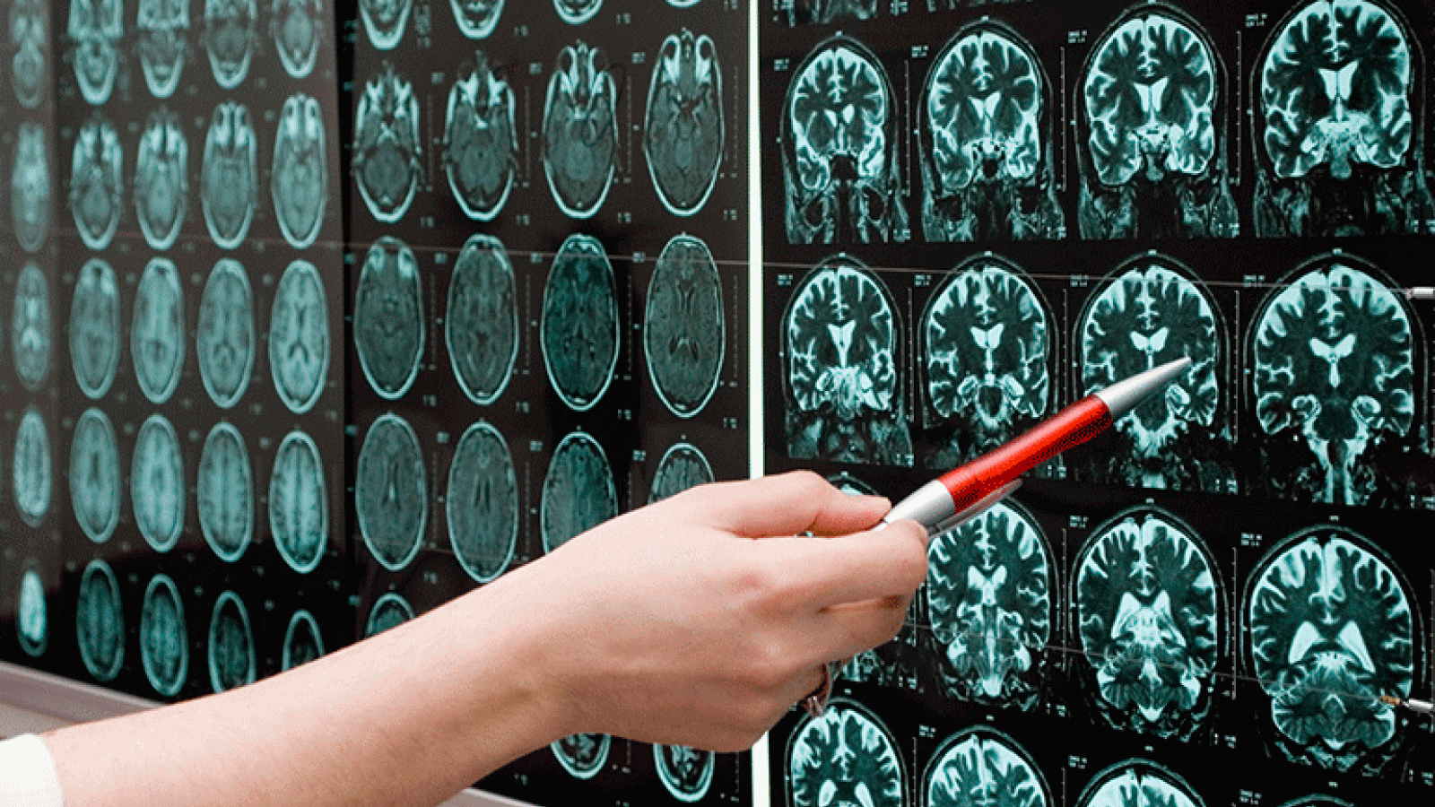 RUSH Copley recognized for stroke care