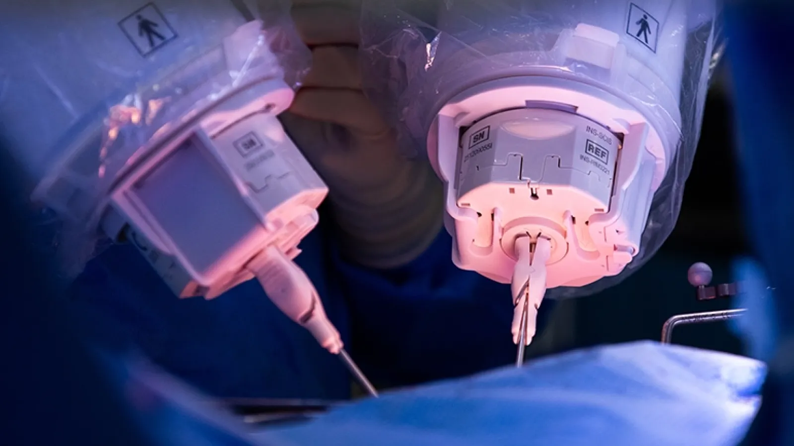 Symani robit surgery
