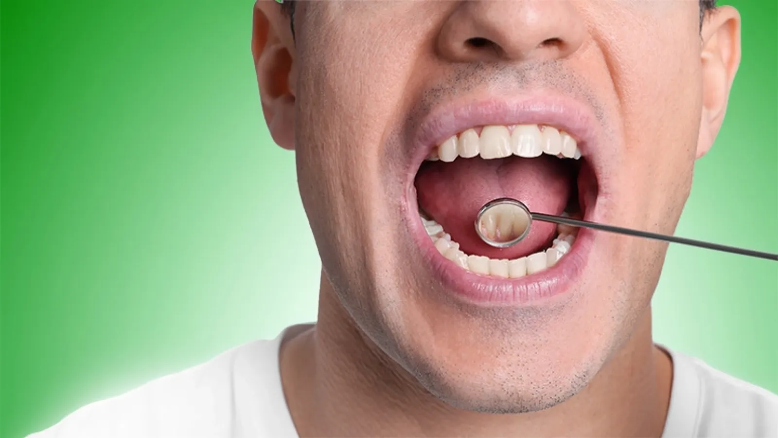 Young man with mouth open at dentist