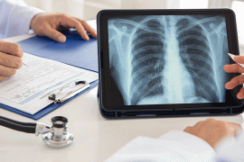 Looking at a picture of a lung screening