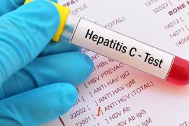 Test vial with "hepatitis C test" written on it over a lab report with a checked box next to "hepatitis c"