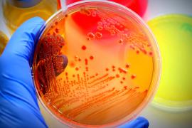 A brightly-colored petri dish with cell cultures