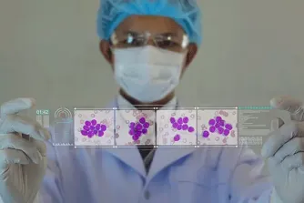 Doctor examining leukemia cells