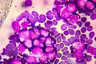 Leukemia cells