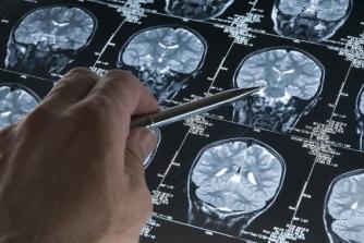 A doctor examining a brain scan