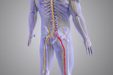 Image of sciatica nerves