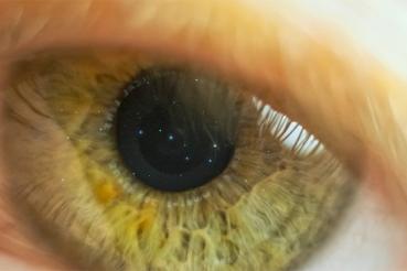 Close-up on a human eye