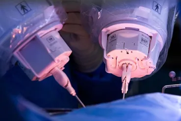 Symani robit surgery