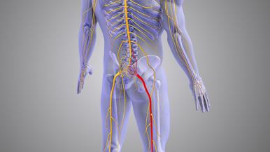 Image of sciatica nerves