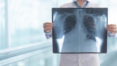 X-ray image of lungs