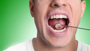 Young man with mouth open at dentist